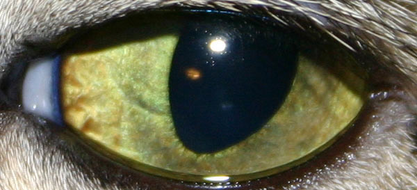 Eye