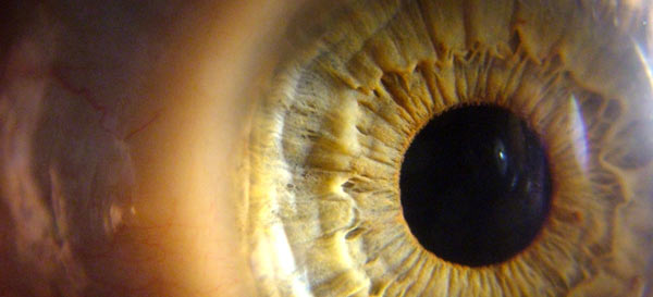 Eye